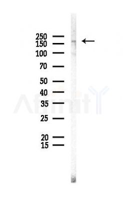 EEA1 Antibody - Western blot analysis of lysates from Rat liver, using EEA1 Antibody at 1/1000 dilution.