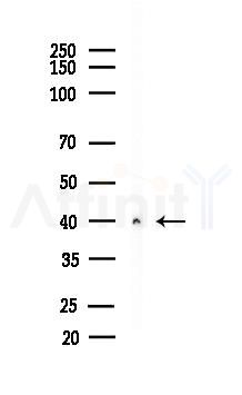 Galectin 8 Antibody - Western blot analysis of lysates from PC12 cells(uv30min treatment), using Galectin 8 Antibody at 1/1000 dilution.