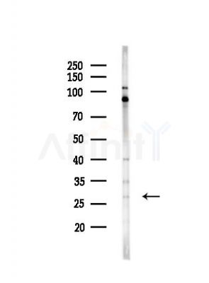 CD53 Antibody - Western blot analysis of lysates from PC12 cells(UV,30min treatment), using CD53 Antibody at 1/1000 dilution.