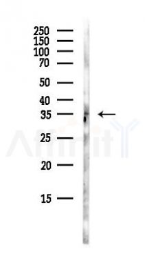 EBP50 Antibody - Western blot analysis of lysates from Mouse brain, using EBP50 Antibody at 1/1000 dilution.