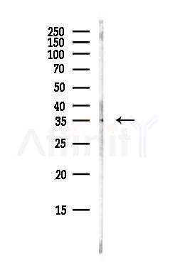 EBP50 Antibody - Western blot analysis of lysates from HepG2 cells(heat-shock, 45min treatment), using EBP50 Antibody at 1/1000 dilution.