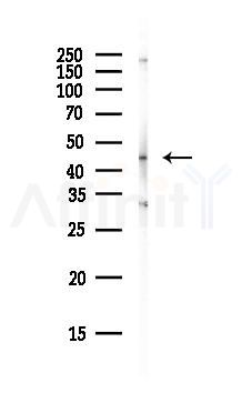 RCC1 Antibody - Western blot analysis of lysates from HepG2 cells(heat-shock, 45min treatment), using RCC1 Antibody at 1/1000 dilution.
