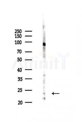 ORM2 Antibody - Western blot analysis of lysates from B16F10-LUC cells(starvation,24h treatment), using ORM2 Antibody at 1/1000 dilution.