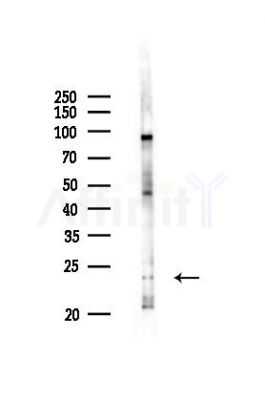ORM2 Antibody - Western blot analysis of lysates from Rat liver, using ORM2 Antibody at 1/1000 dilution.
