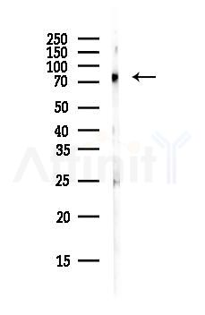 TAB3 Antibody - Western blot analysis of lysates from Mouse brain, using TAB3 Antibody at 1/1000 dilution.