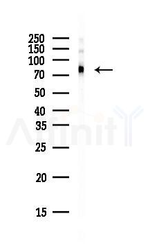 TAB3 Antibody - Western blot analysis of lysates from HepG2 cells(heat-shock, 45min treatment), using TAB3 Antibody at 1/1000 dilution.