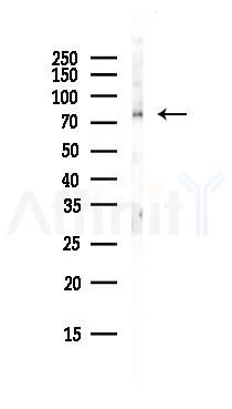 TAB3 Antibody - Western blot analysis of lysates from HepG2 cells(starvation, 24h treatment), using TAB3 Antibody at 1/1000 dilution.