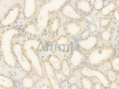TAB3 Antibody - DF8284 at 1/100 staining human normal kidney tissue by IHC-P.