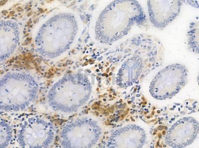 CDX4 Antibody - DF8285 at 1/100 staining human normal colon tissue by IHC-P.