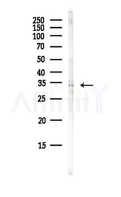 SIRT5 Antibody - Western blot analysis of lysates from HepG2 cells(heat-shock, 45min treatment), using SIRT5 Antibody at 1/1000 dilution.