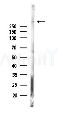 DSP Antibody - Western blot analysis of lysates from K562 cells(UV,30min treatment), using DSP Antibody at 1/1000 dilution.