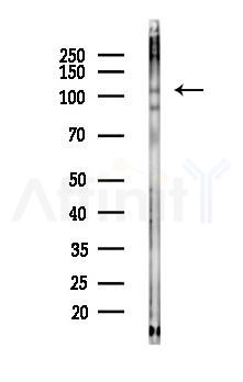 Phospho-IRE1 (Ser724) Antibody - Western blot analysis of lysates from HepG2 cells(heat-shock,45min treatment), using Phospho-IRE1 (Ser724) Antibody at 1/1000 dilution.