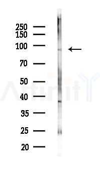 ADAM15 Antibody - Western blot analysis of lysates from HepG2 cells(heat-shock,45min treatment), using ADAM15 Antibody at 1/1000 dilution.