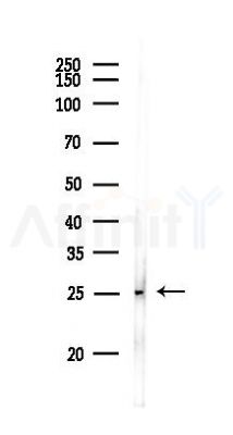 DDIT4 Antibody - Western blot analysis of lysates from PC12 cells, using DDIT4 Antibody at 1/1000 dilution.