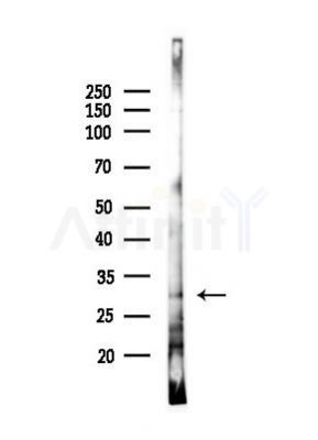 HLA-DRB1 Antibody - Western blot analysis of lysates from EC304 cells(heat-shock,45min treatment), using HLA-DRB1 Antibody at 1/1000 dilution.