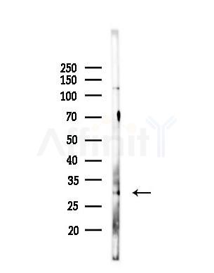 HLA-DRB1 Antibody - Western blot analysis of lysates from B16F10-LUC cells(heat-shock,45min treatment), using HLA-DRB1 Antibody at 1/1000 dilution.