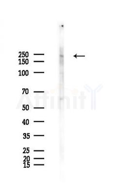 CHD5 Antibody - Western blot analysis of lysates from Mouse testis, using CHD5 Antibody at 1/1000 dilution.