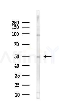CD209 Antibody - Western blot analysis of lysates from HepG2 cells(heat-shock,45min treatment), using CD209 Antibody at 1/1000 dilution.