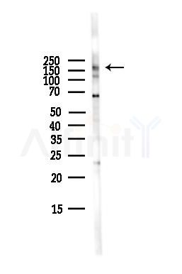 PIK3R4 Antibody - Western blot analysis of lysates from HepG2 cells(LPS,4h treatment), using PIK3R4 Antibody at 1/1000 dilution.
