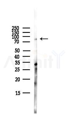 GHR Antibody - Western blot analysis of lysates from HepG2 cells(LPS,4h treatment), using GHR Antibody at 1/1000 dilution.