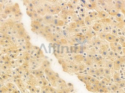 EIF3B Antibody - DF8429 at 1/100 staining human normal liver tissue by IHC-P.