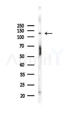 MGEA5 Antibody - Western blot analysis of lysates from Hela cells(starvation,24h treatment), using MGEA5 Antibody at 1/1000 dilution.
