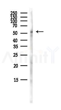 RXR alpha Antibody - Western blot analysis of lysates from Mouse liver, using RXR alpha Antibody at 1/1000 dilution.