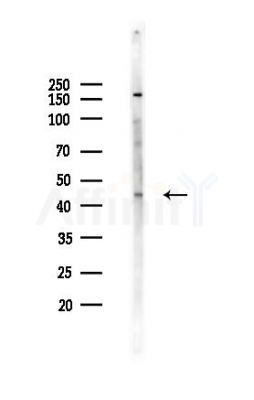 ETV2 Antibody - Western blot analysis of lysates from K562 cells(UV,30min treatment), using ETV2 Antibody at 1/1000 dilution.