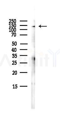 MYBBP1A Antibody - Western blot analysis of lysates from HepG2 cells(LPS,4h treatment), using MYBBP1A Antibody at 1/1000 dilution.