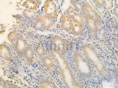 TAT Antibody - DF8469 at 1/100 staining human normal gastric tissue by IHC-P.