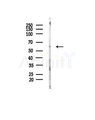 AChR alpha3 Antibody - Western blot analysis of lysates from Mouse liver, using AChR alpha3 Antibody at 1/1000 dilution.