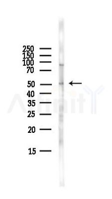 ALDH3A1 Antibody - Western blot analysis of lysates from HepG2 cells(LPS,4h treatment), using ALDH3A1 Antibody at 1/1000 dilution.