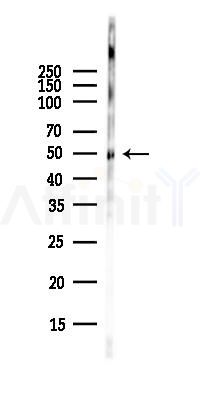 ALDH3A1 Antibody - Western blot analysis of lysates from EC304 cells(heat-shock,45min treatment), using ALDH3A1 Antibody at 1/1000 dilution.