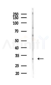 ASCL1 Antibody - Western blot analysis of lysates from HepG2 cells(heat-shock,45min treatment), using ASCL1 Antibody at 1/1000 dilution.