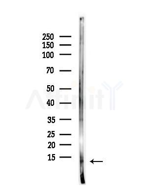 Cholecystokinin/CCK Antibody - Western blot analysis of lysates from EC304 cells(heat-shock,45min treatment), using Cholecystokinin/CCK Antibody at 1/1000 dilution.