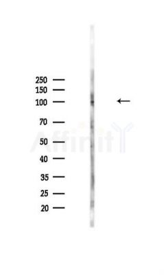 CD42b Antibody - Western blot analysis of lysates from HepG2 cells(heat-shock,45min treatment), using CD42b Antibody at 1/1000 dilution.