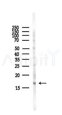 eIF5A2 Antibody - Western blot analysis of lysates from HepG2 cells(LPS,4h treatment), using eIF5A2 Antibody at 1/1000 dilution.