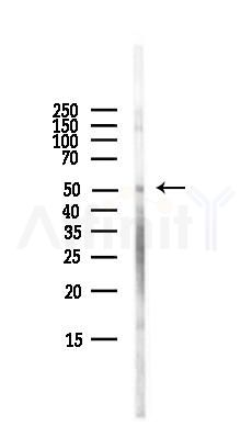 ENT1 Antibody - Western blot analysis of lysates from HepG2 cells(LPS,4h treatment), using ENT1 Antibody at 1/1000 dilution.
