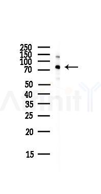EOMES Antibody - Western blot analysis of lysates from HepG2 cells(LPS,4h treatment), using EOMES Antibody at 1/1000 dilution.