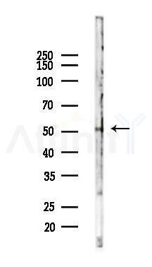 GABAA R alpha1 Antibody - Western blot analysis of lysates from A375 cells(heat-shock,45min treatment), using GABAA R alpha1 Antibody at 1/1000 dilution.
