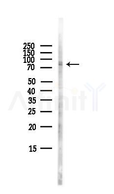 HIF-3 alpha Antibody - Western blot analysis of lysates from HepG2 cells(LPS,4h treatment), using HIF-3 alpha Antibody at 1/1000 dilution.