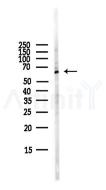 PDLIM5 Antibody - Western blot analysis of lysates from HepG2 cells(LPS,4h treatment), using PDLIM5 Antibody at 1/1000 dilution.