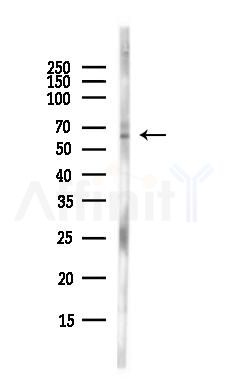 PDLIM5 Antibody - Western blot analysis of lysates from EC304 cells(heat-shock,45min treatment), using PDLIM5 Antibody at 1/1000 dilution.