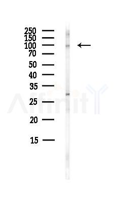 ZFP598 Antibody - Western blot analysis of lysates from HepG2 cells(heat-shock,45min treatment), using ZFP598 Antibody at 1/1000 dilution.