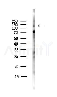 ZO-2 Antibody - Western blot analysis of lysates from Hela cells(starvation,24h treatment), using ZO-2 Antibody at 1/1000 dilution.