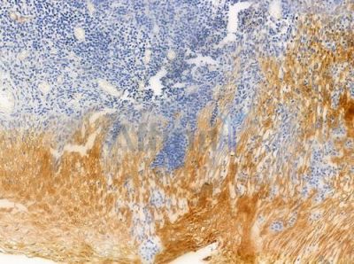 ACTN1/2/3/4 Antibody - DF8633 at 1/100 staining human normal tonsil tissue by IHC-P.