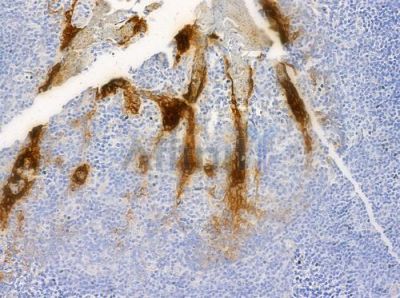 ACTN1/2/3/4 Antibody - DF8633 at 1/100 staining human normal tonsil tissue by IHC-P.
