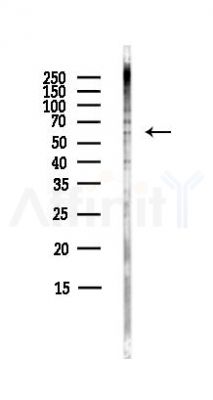 ADCK4 Antibody - Western blot analysis of lysates from HepG2 cells(heat-shock,45min treatment), using ADCK4 Antibody at 1/1000 dilution.