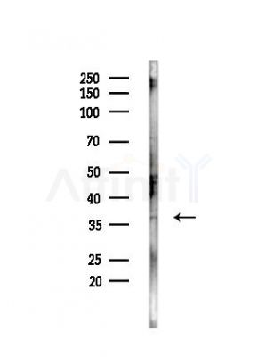 ADORA2B Antibody - Western blot analysis of lysates from HepG2 cells(heat-shock,45min treatment), using ADORA2B Antibody at 1/1000 dilution.