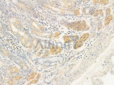 AurB/C Antibody - DF8639 at 1/100 staining human normal gastric tissue by IHC-P.